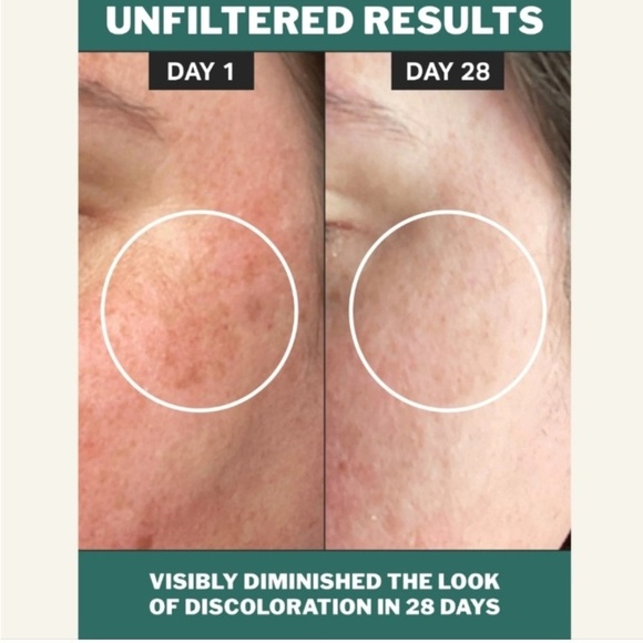 Cocokind chlorophyll discoloration serum 1 fl oz bottle - Picture 9 of 12